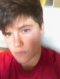 Trans man's progress over the years