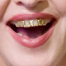 However, you'll have to give it serious time and thoughts. Grillz Have Risen But Do They Harm Your Teeth