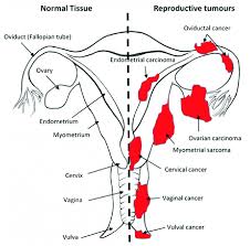 The anther is the part of the organ that produces pollen, and the filaments hold up the anthers. Sites Of Gynaecological Cancers In The Female Reproductive Tract The Download Scientific Diagram