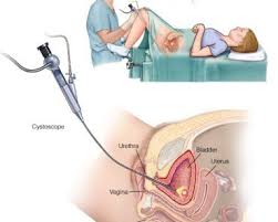 Pin On Bladder Cancer Natural Cure Home Remedies Treatment Options
