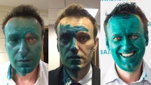 We did not find results for: Navalnomu Prooperirovali Glaz V Klinike Barselony