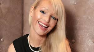 Acid attack model Katie Piper says: 'I wouldn't want my old face back now..  the good outweighs the bad'