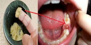 We did not find results for: Sakit Gigi Kronis Coba Ramuan Dahsyat Ini Dan Rasakan Keajaiban Setelah 5 Detik Kemudian