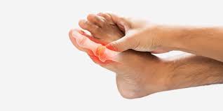 Image result for gout symptoms knee