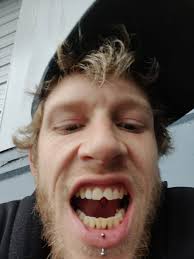 If i bite my lips it's not to flirt, I'm just ripping the skin off my lips  because of stress