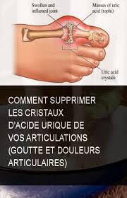 Pin On Astuces Sante