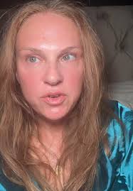 Nurse Jane Roller under Eyes