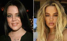 Obviously, people can do what they want, but i don't understand why this gal got all the plastic surgery. 14 Reality Stars Who Have Completely Transformed Themselves