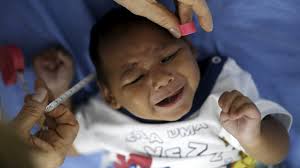 Microcephaly cases in Brazil predate Zika virus outbreak, study says