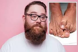 Ini berlaku apabila buah pinggang anda tidak dapat memproses jumlah glukosa yang tinggi dalam badan. Gejala Diabetes Tipe 2 5 Tanda Di Kaki Tunjukkan Gula Darah Tinggi