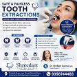 Tooth Extractions