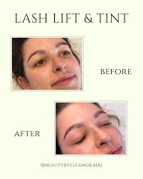 Naturally lifted, effortlessly beautiful ✨🤍