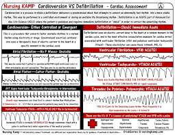 Telemetry Defibrillation Vs Cardioversion Cardiac Nursing