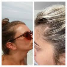 What can I use to stimulate hair growth? My hair line has been thinning  over the last few years, I think because I wear it up the majority of the  time. But