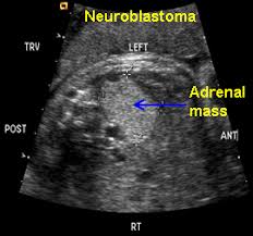 Pin On Sonography