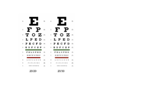 Over 1.3 million surgeries performed. Which Is Better 20 20 Or 20 30 Vision Quora