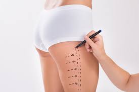 The Benefits Of Thigh Lift Surgery Hz Plastic Surgery