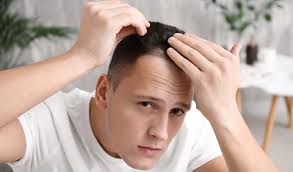 5 Ways to Stop Hair Loss – Tiege Hanley