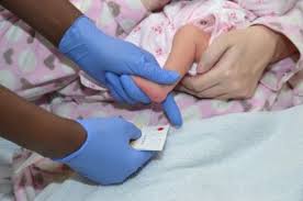 Image result for Infant Blood Sample