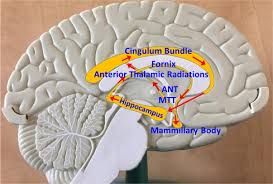 Image result for Thalamic Stimulation