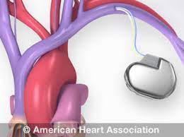 Devices of this sort are very easy to use, and you can buy them for a few dollars. Living With Your Pacemaker American Heart Association
