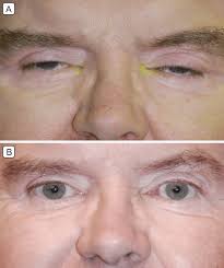 Image result for Blepharis obermeyerae