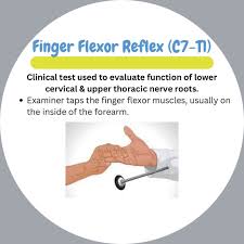 Image result for Reflex Exam