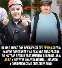 Nació con una rara enfermedad que no le permitía sentir saciedad, lo que lo  llevó a vivir con hambre constante desde muy pequeño. A los cinco años, su  peso alcanzó los 90