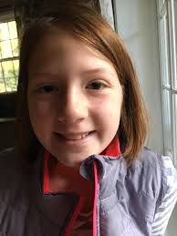 What would you suggest for a 12 year old girl experiencing acne?