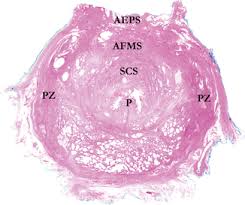 Although screenings for prostate cancer are one tool for early detecti. Anatomy Of The Prostate Revisited Implications For Prostate Biopsy And Zonal Origins Of Prostate Cancer Basicmedical Key