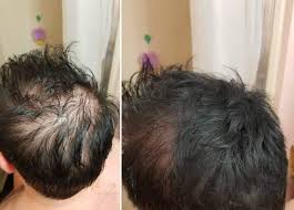 Just 26 Hair Products With Impressive Before And After Photos