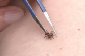 Some dogs are cooperative though, and removing ticks embedded in their skin is a lot easier process. How To Remove A Tick Embedded In The Skin Video Bass Pro Shops