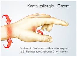We did not find results for: Waschmittelallergie Ursachen Beschwerden Therapie Gesundpedia De