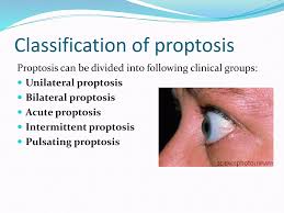 Image result for Proptosis