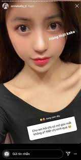 Trang Anna lần đầu chia sẻ chuyện phẫu thuật thẩm mỹ, hot girl có màn dao  kéo thành công nhất là đây chứ đâu!