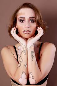 Mari Prado faz ensaio fotográfico e comenta sobre autoaceitação ao Vitiligo