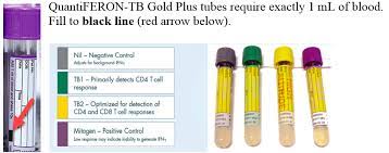 Tuberculosis using whole blood specimen. Alberta Precision Laboratories Lab Services