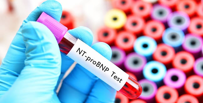 NT PRO BNP product image