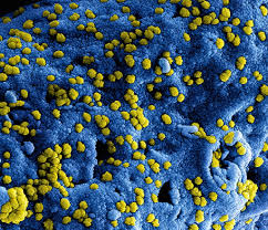I guess its a waiting game now? Epidemics And Wildlife Can We Drink Camel Milk Amid Mers Outbreaks Cgtn