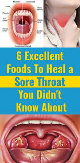 6 Foods You Had No Idea Were Destroying Your Hormones And Your Skin Heal Sore Throat Sore Throat Soreness