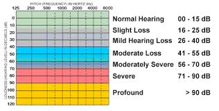 Hearing Loss Education On Hearing Loss