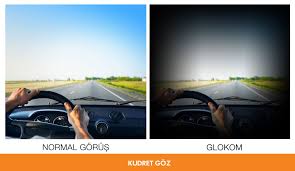 Fotograftaki Gibi Bir Goruse Sahipseniz Glokom Rahatsizliginiz Olabilir Ve Cok Gecmeden Mutlaka Bir Doktora Danismaniz Gerekmektedir Simsek Doktorlar Fotograf