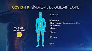 Gbs is a rare but. Tem Noticias 1Âª Edicao Bauru Marilia Complicacoes Da Covid 19 Podem Evoluir Para Sindrome De Guillain Barre Assista Online Globoplay