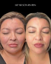 𝘓𝘪𝘻 𝘕𝘦𝘭𝘴𝘰𝘯 𝘙𝘕 𝘉𝘚𝘕 (@fwlizdiane) • Instagram photos and videos