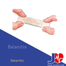 Image result for Balanitis