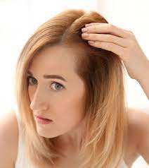 Because lupus causes widespread inflammation throughout the body just because you may be experiencing hair loss does not mean that you have lupus. Lupus Hair Loss Causes Symptoms And Tips To Prevent It