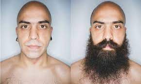 How to get rid of bumps from plucking. Should You Shave Your Facial Hair 7 Scenarios Explained