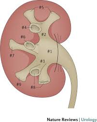 Image result for STONE Score