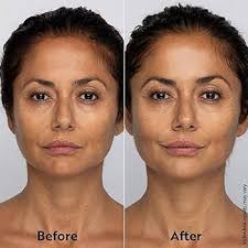 Amazon.com: M. Asam VITAMIN C Glow Face Cream (1.69 Fl Oz)