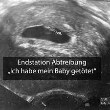Sie abtreibung & schwangerschaftsabbruch in wien. Die Rabenmutti Abtreibung Es War Mein Baby Und Ich Habe Es Umgebracht Eltern De